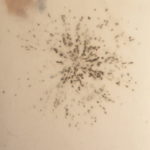Culture Plate of Verticillium dahliae grown from soil sample